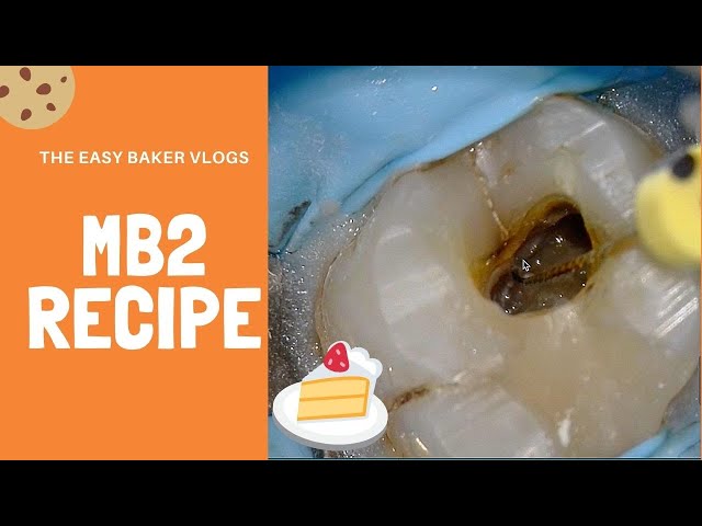 Maxillary Molar Root Canal - The Hunt for MB2 class=