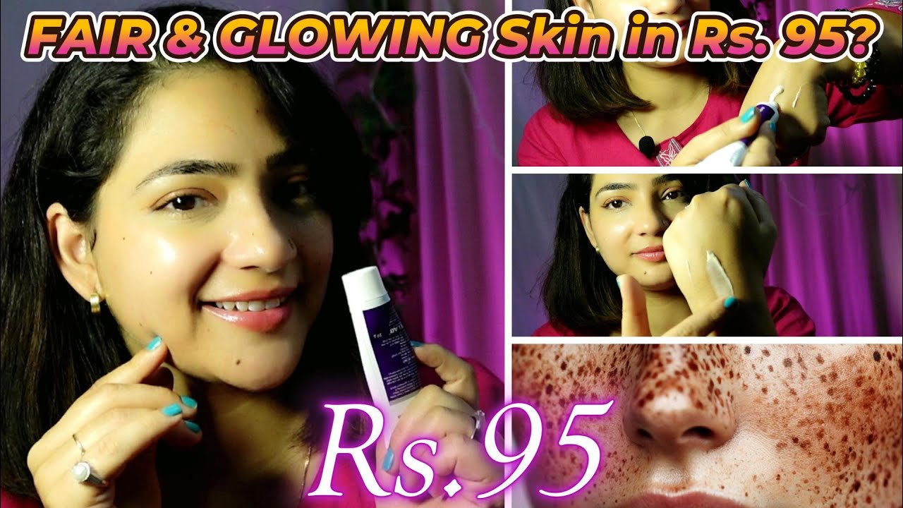 This Rs. 95 Cream Faded My Acne Marks?! | Zeelab Kojic Acid + Vitamin C Honest Review