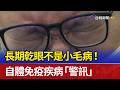 長期乾眼不是小毛病！ 自體免疫疾病「警訊」