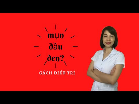 Cách điều trị mụn đầu đen