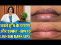 Causes &amp; Treatment of Dark Lips || काले होंठ के कारण और ईलाज
