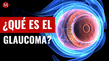 ¿Cómo se contrae el glaucoma?