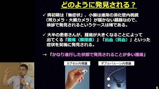 【第8回　希少がん Meet the Expert：小腸がん】講演