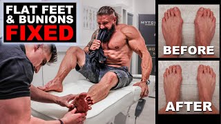 The WORST PAIN | Fixing BUNIONS \& FLAT FEET Without Surgery! | Trigger Point Therapy (Lex Fitness)