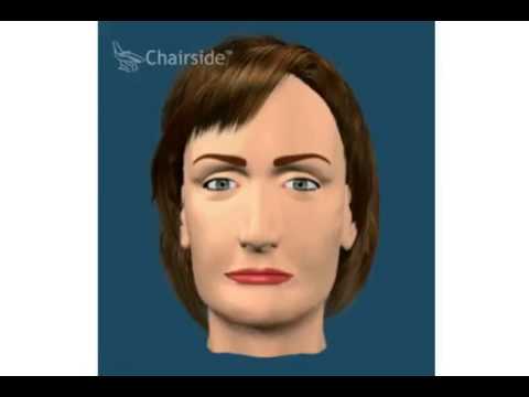 как атрофия челюсти меняет выражение лица человека