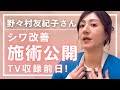 TV収録前日に“ガチ施術”！野々村友紀子さんのシワ改善ドキュメント公開