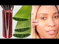 HOW TO MAKE ANTI   AGING SERUM USING ALOE VERA GEL AT HOME, REDUCE WRINKLES, BOOST COLLAGEN