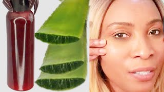 HOW TO MAKE ANTI   AGING SERUM USING ALOE VERA GEL AT HOME, REDUCE WRINKLES, BOOST COLLAGEN