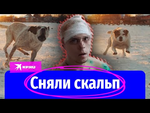 Житель Хабаровска стал жертвой нападения собак