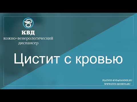 555  Цистит с кровью