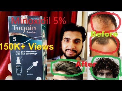 वीडियो: Hair4U टॉपिकल समाधान समीक्षा