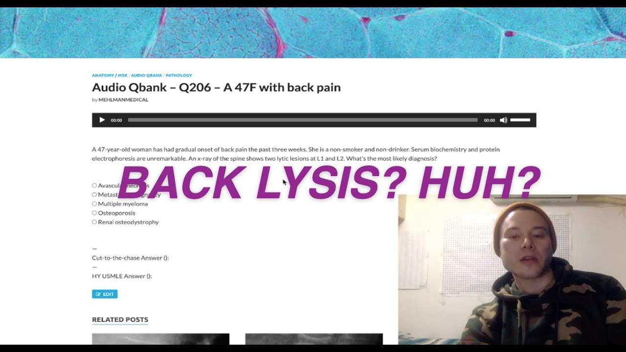 Audio Qbank - Q206 - A 47F with back pain