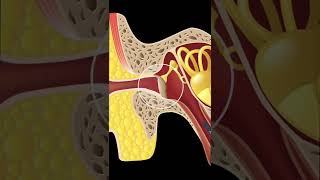 05 RETRACTED EARDRUM RETRACTION POCKETS EXPLAINED #SHORTS