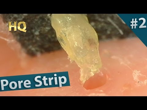 #2 Pore Strip Close up - Blackheads Removal