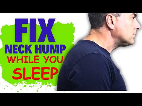 WEIRD POSTURE FIX: Does This FIX Your Neck Hump While Sleeping?
