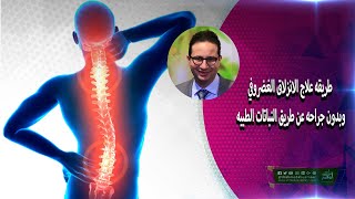 طريقه علاج الانزلاق الغضروفي وبدون جراحه عن طريق النباتات الطبيه   الدكتور أحمد أبوالنصر