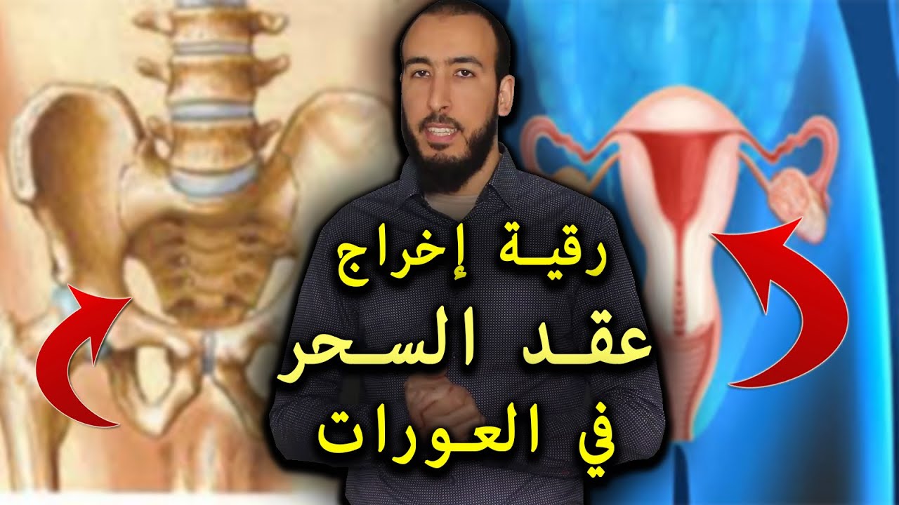 رقية إخراج عقد السحر في العورات إذا كنت تعاني من استقرار المس في العورة فهذه الرقية تهم حالتك %100