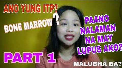 MY LUPUS JOURNEY PART 1 + TIPS | Ghislain Vlogs