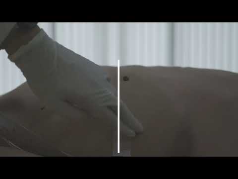 CVP measurement2