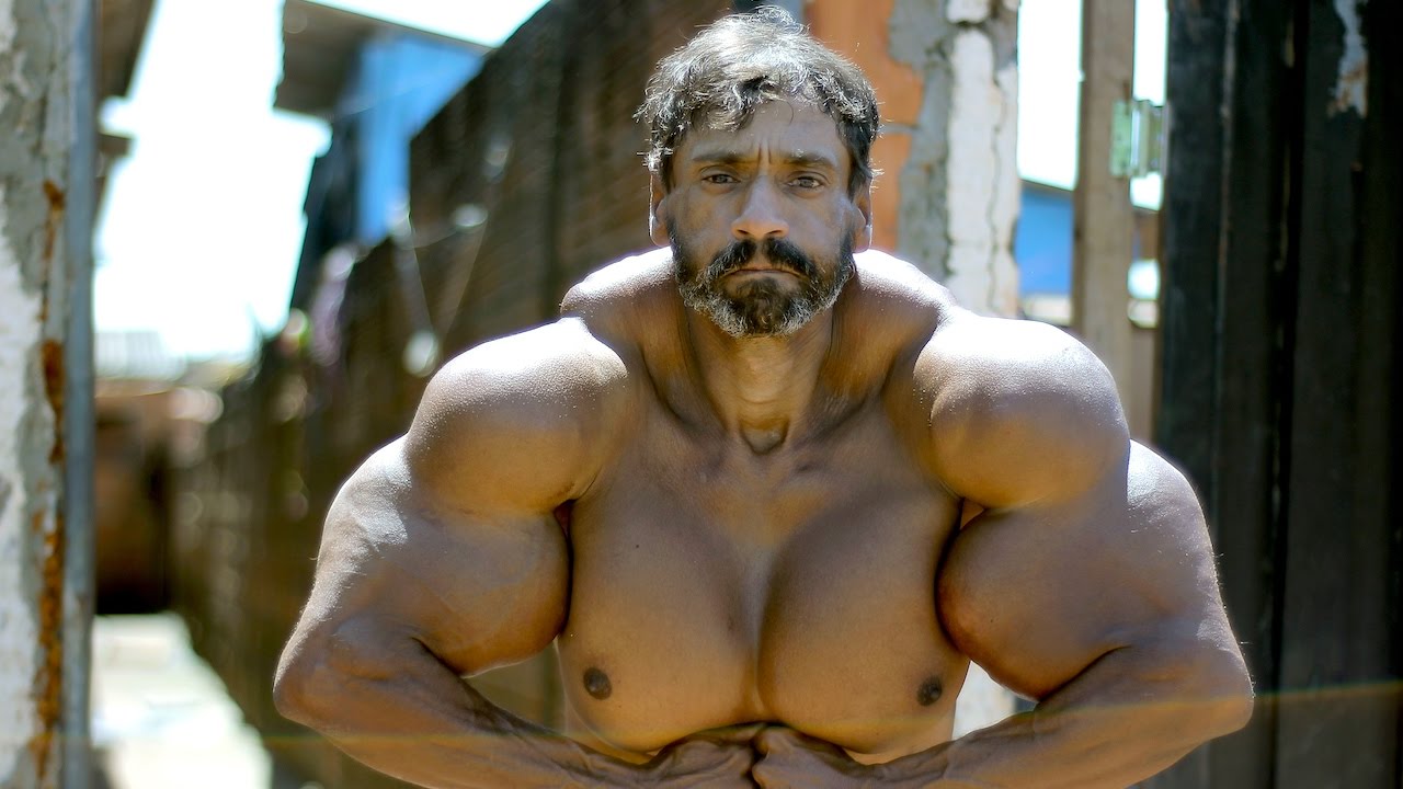 Synthol Man Dies