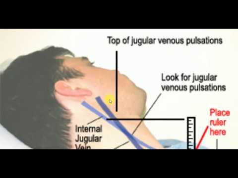 JUGULAR VENOUS PRESSURE , MEDICINE LECTURES , Cardiology Lectures ...