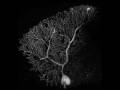 Cerebellar purkinje neuron