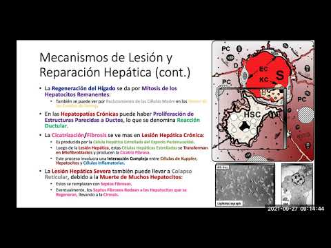 2021 2 Enfermedades del Higado Via Biliar y Pancreas Patologia Fisioterapia