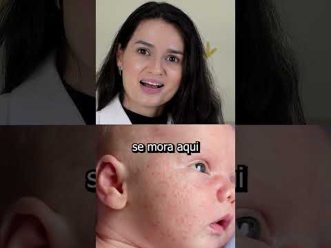 Brotoeja pode ser
