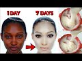 Skin whitening in 3 days! Get skin white as snow and clear as glass