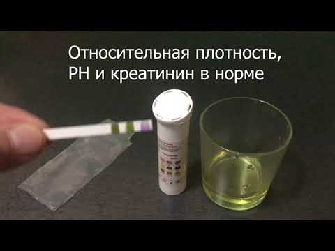 Синтетическая моча - как проверить