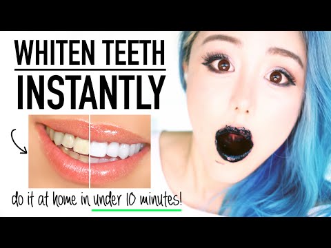 BEAUTY HACKS Whiten Teeth Instantly At Home in Under 10 Minutes Naturally ♥ Before & After Whitening