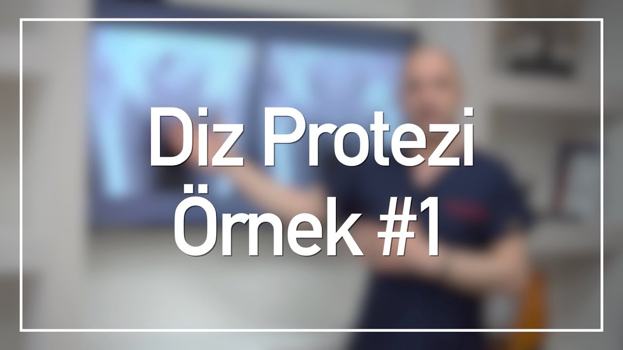 Diz Kireçlenme Tedavisi | Diz Protezi Örnekleri #1