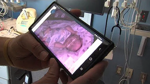 NICU cameras give parents 24/7 access to babies