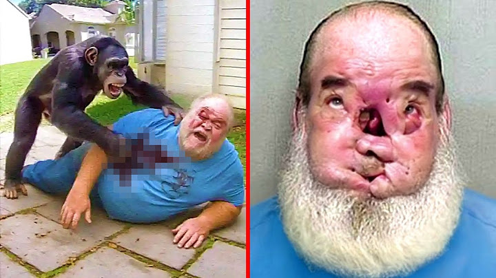 The Deadliest Ape Attacks: The Charla Nash Tragedy
