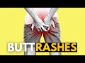 Butt Rashes What You Need To Know Butt Rashes What You Need To Know