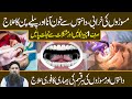 Danto Ka Mass Khora Ka Ilaj Gums Ki Sujan Gums Ki Swelling Peele Danto Ka Ilaj Dr Sharafat Ali