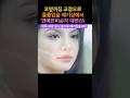 코옆꺼짐, 잇몸 돌출, 메기입술, 하관까지? 한 번에 해결하는 방법!