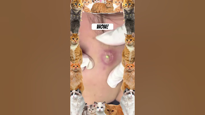 Wow! #ytshorts #pimplepopper #blackheadremoval #pimplepopping #pimpleextraction #youtube #pimple