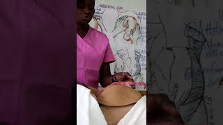 Fundal height using a tape measure