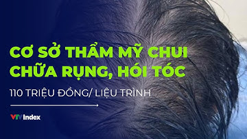 Bên trong cơ sở chữa rụng tóc, hói đầu chui với 110 triệu đồng/ liệu trình | VTVIndex