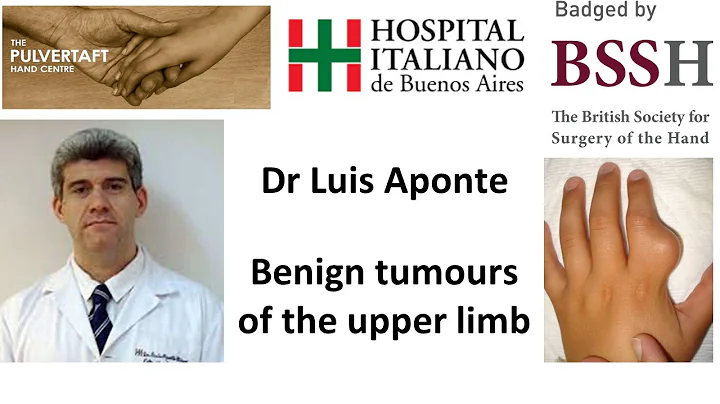 Management of benign tumours of the upper limb by Dr Luis Aponte - DayDayNews