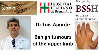 Management of benign tumours of the upper limb by Dr Luis Aponte screenshot 2