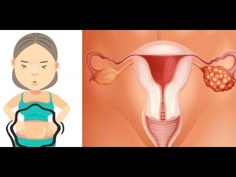 Remedio casero para dolor menstrual fuerte