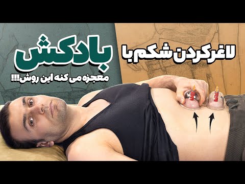 راز لاغری شکم با بادکش چربی سوزی شکم و رفع نفخ و یبوست بدون ورزش یا رژیم غذایی خاص