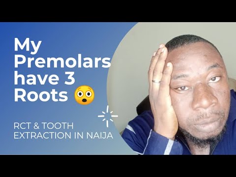 RCT & Tooth extraction in Nigeria | The cost  of Dental care in Nigeria | Gift Adene's Experience