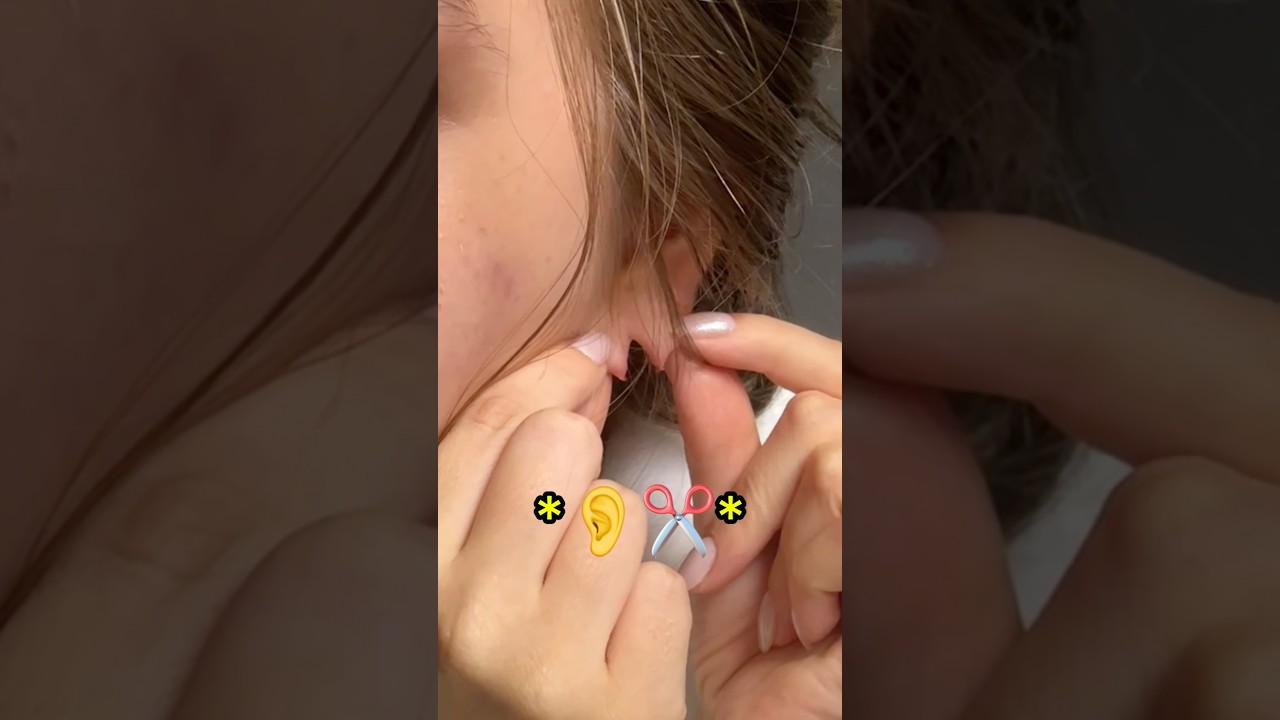 ME LASQUEI 🫢👂😱 