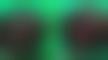 En bloc Right Tri-segmentectomy. Bismuth-Corlette Type 3A perihilar cholangiocarcinoma, part 3