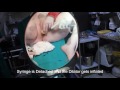 Gender Correction Surgery Male to Female Post op Dilation (Sigmoid Colon + Penile Inversion)