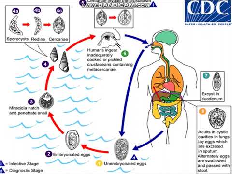 Video: Apa stadium infektif paragonimus westermani?