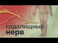 Самые простые и безболезненные упражнения  от боли в седалищниом нерве